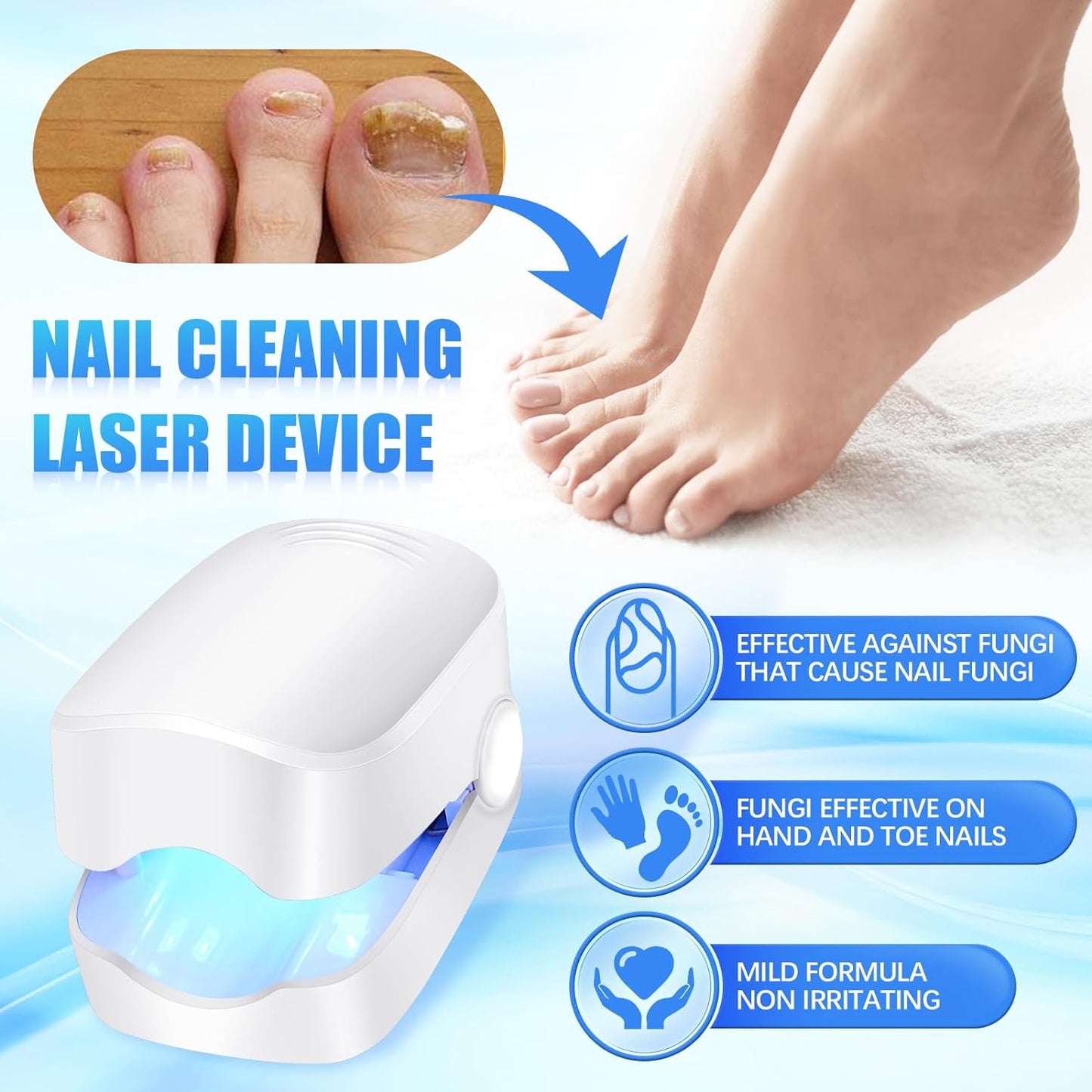 Rechargeable Nail Fungus Treatment For Toenail Toe Nail Fungal Treatment Nail Fungus Laser Device Anti-fungal Nail Treatment For Hand Feet Infections Remover For Home Use