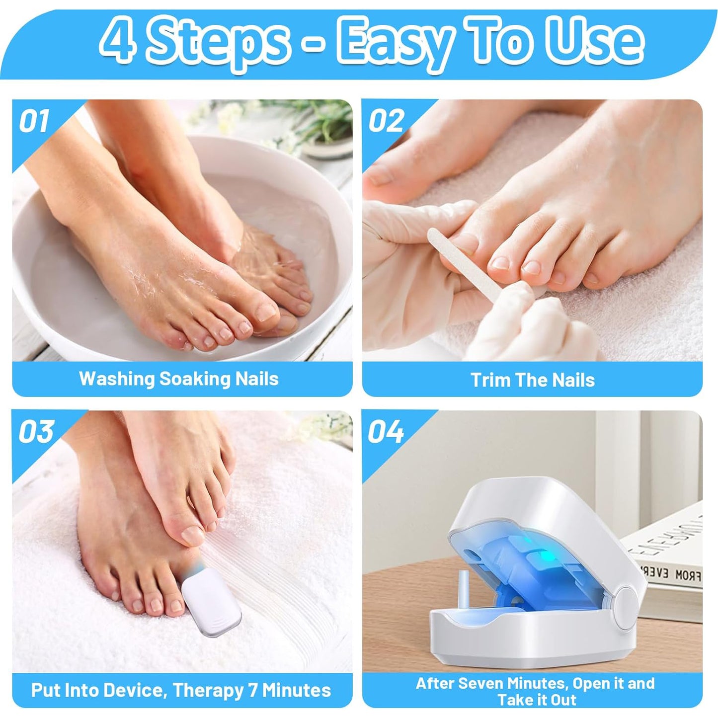 Rechargeable Nail Fungus Treatment For Toenail Toe Nail Fungal Treatment Nail Fungus Laser Device Anti-fungal Nail Treatment For Hand Feet Infections Remover For Home Use