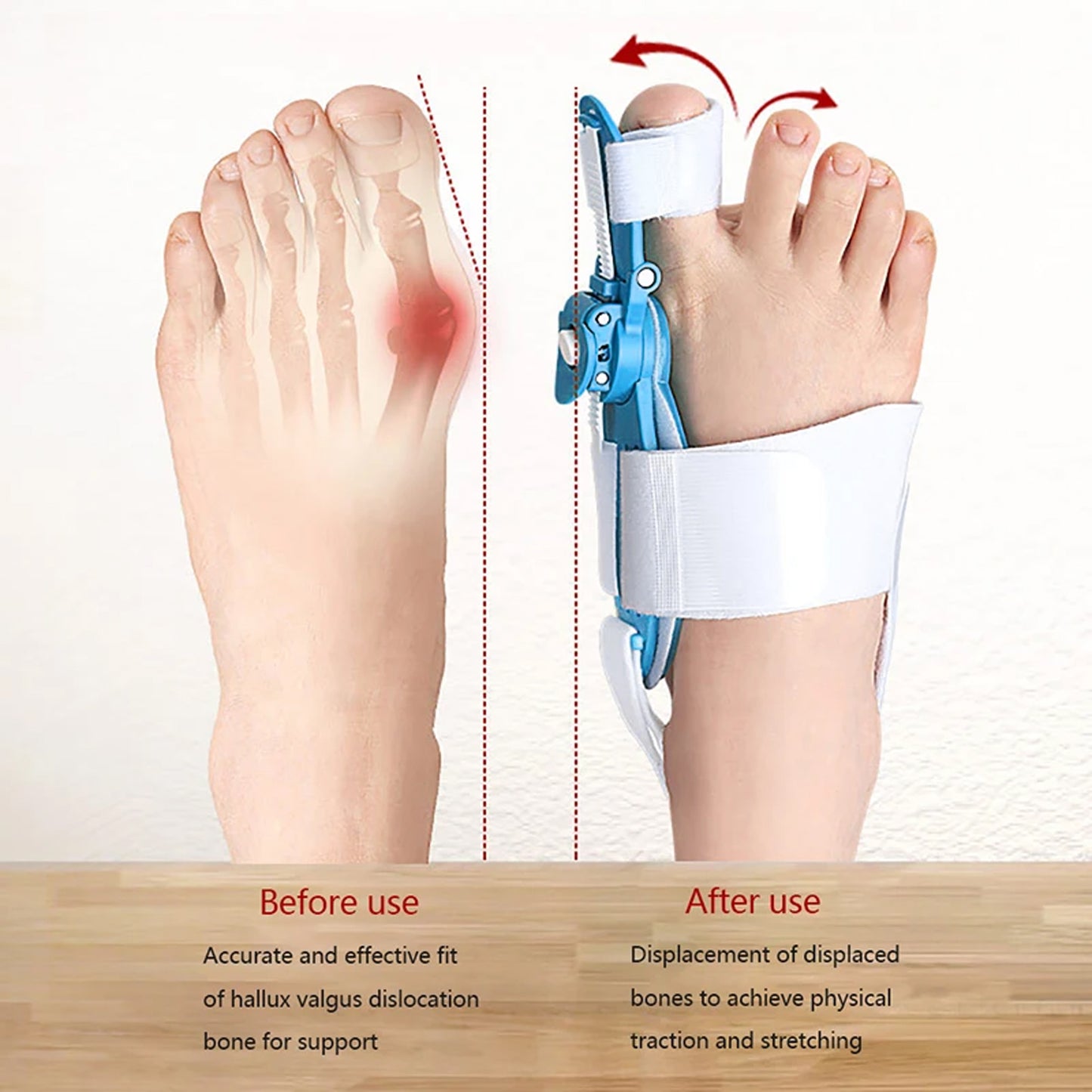 Bunion Support Splint. Valgus And Bunion Valgus Corrector Hallux Valgus Corrector Adjustable Bunion Valgus Protective Cover For Men And Women