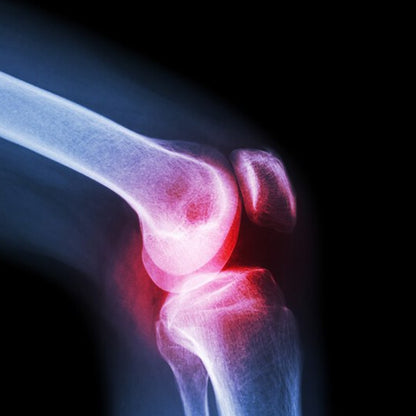 (Large) Knee Cap For Knee Support